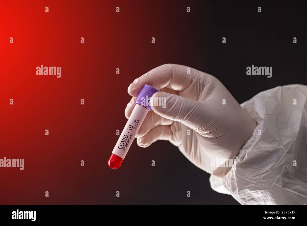 Hände eines Labortechnikers mit einem Röhrchen Blutprobe bereit für die Prüfung. Globale Pandemie mit Coronavirus COVID-19-Konzept Stockfoto