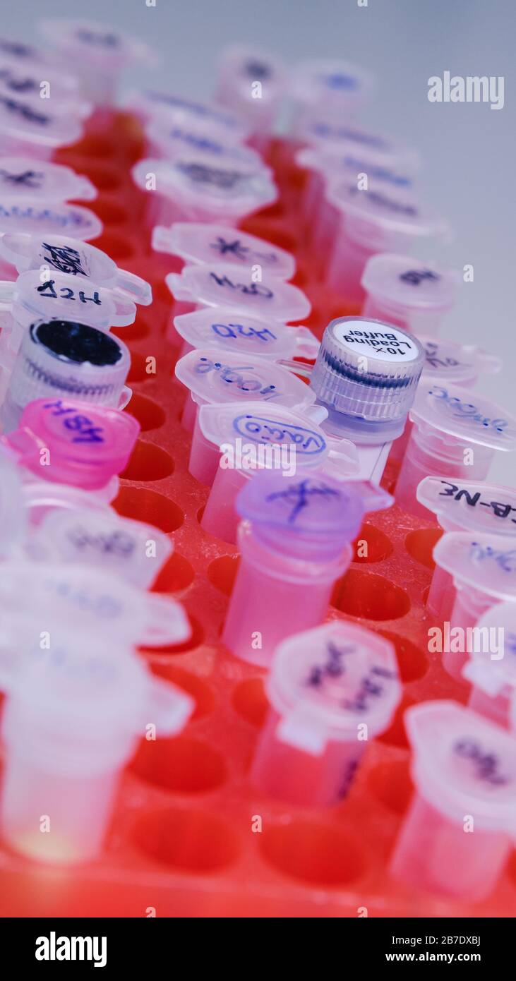 Laborgestell mit Kunststoffröhrchen für DNA-Untersuchungen. DNA-Gel-Beladung. Konzept der Wissenschaft, des Labors und der Erforschung von Krankheiten. Stockfoto