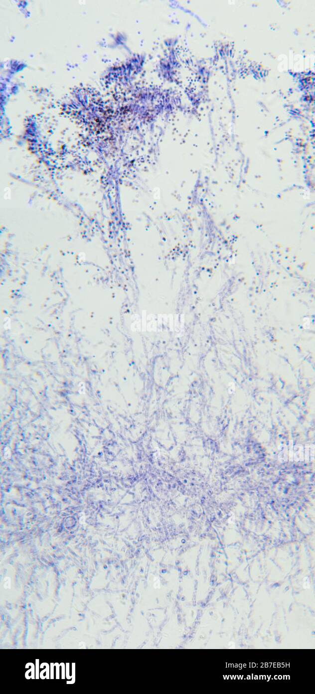 Penicillium, ascomycetöse Pilze, Detail, unter dem Mikroskop. Für den Menschen sind Ascomyceten eine Quelle von medizinischen Verbindungen, wie Antibiotika. Stockfoto