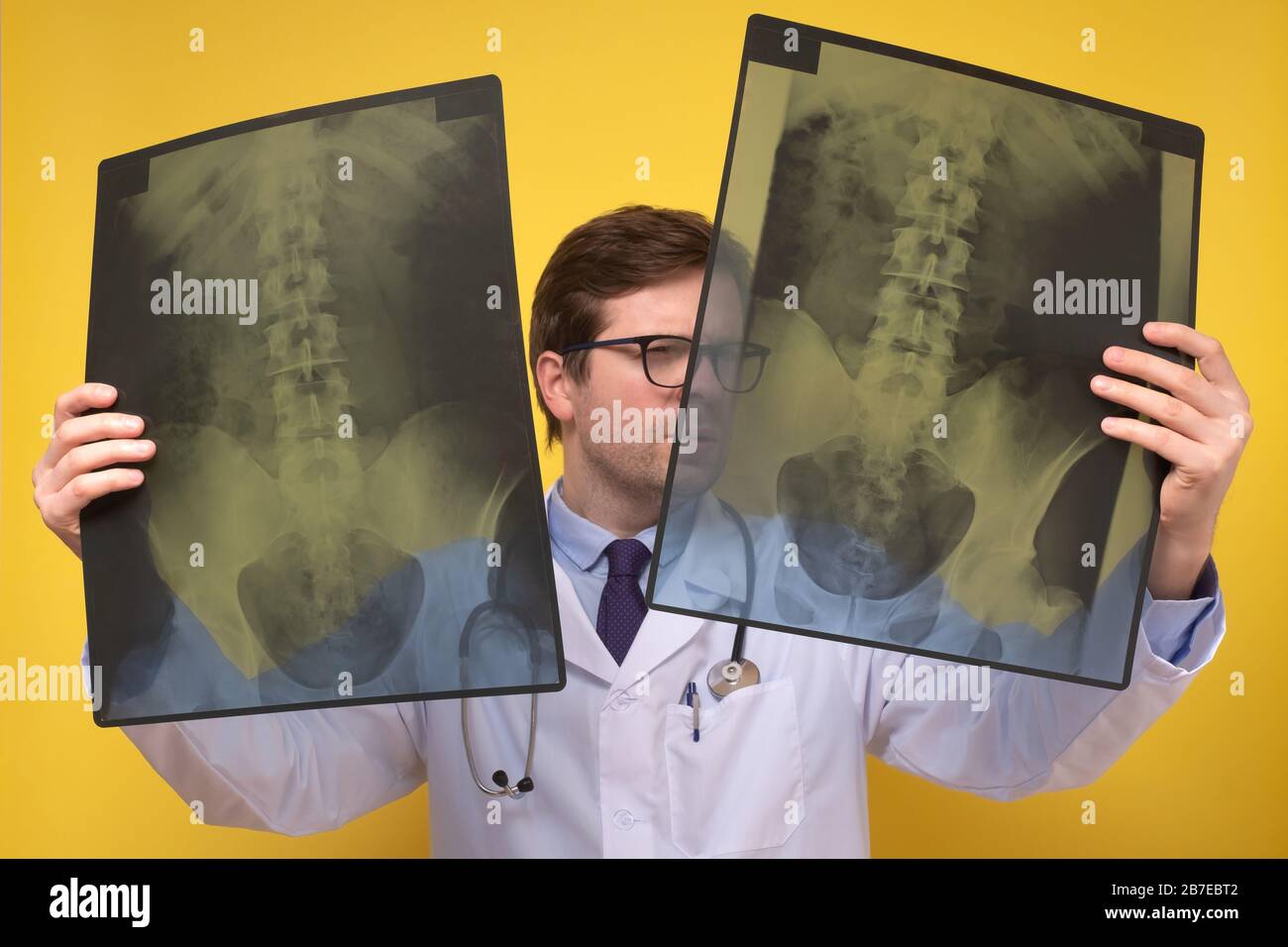 Der kaukasische Radiologe überprüft die Röntgenspinnen und Nieren. Stockfoto