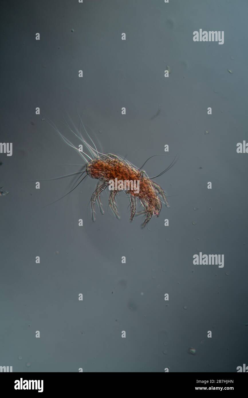 Hausstaubmilben unter dem Mikroskop 100x Stockfotografie - Alamy