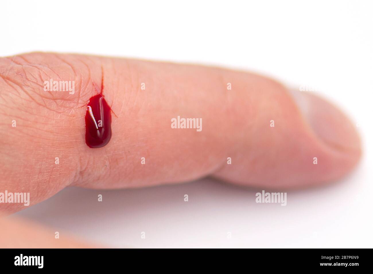 Nahfinger mit natürlicher Wunde und Bluttropfen, verletzter Finger Stockfoto