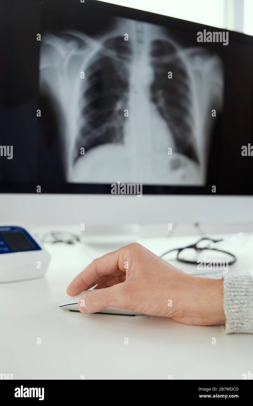 Nahaufnahme eines jungen Arztes, der an seinem Schreibtisch sitzt und einen Röntgenbild der Brust in seinem Computer überprüft Stockfoto