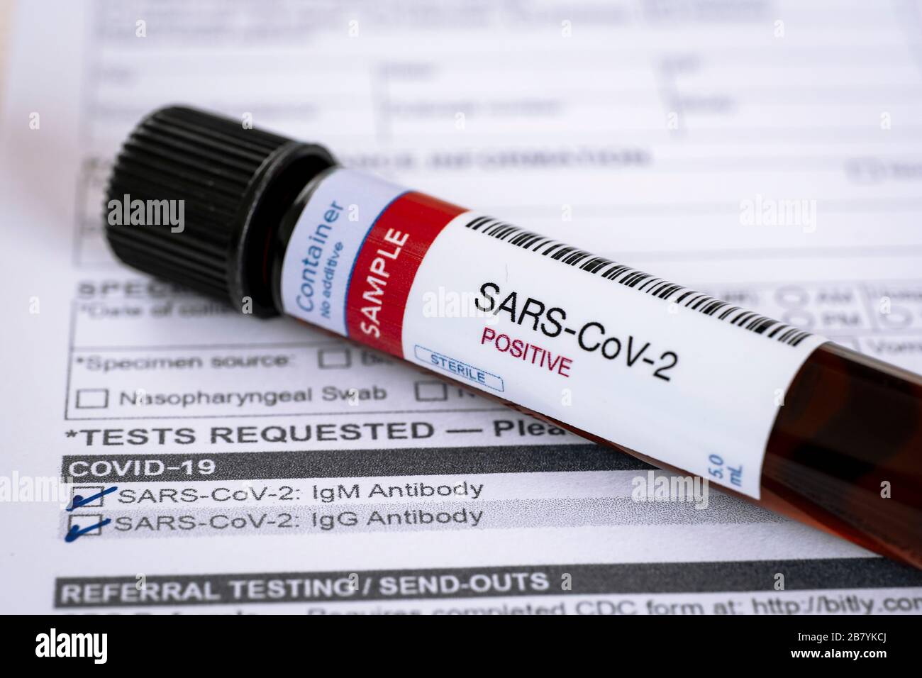 Prüfung auf Vorhandensein von Coronavirus. Röhrchen mit einer Blutprobe, die positiv auf COVID-19 getestet wurde. Testformular im Hintergrund. Stockfoto