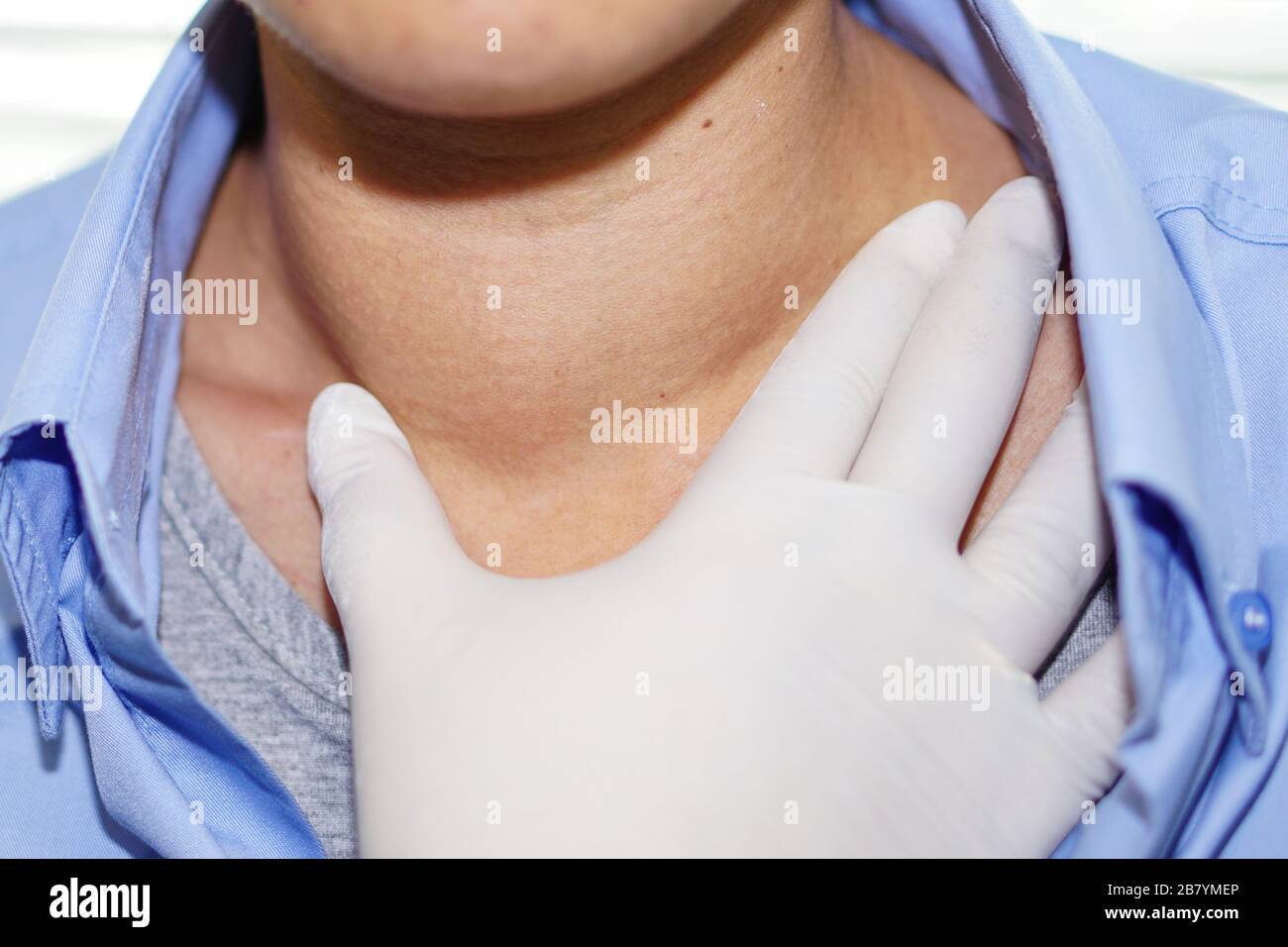 Asiatische Dame Frau Patienten abnorme Vergrößerung der Schilddrüse Hyperthyreose (Überfunktion der Schilddrüse) an der Kehle: Gesunde starke Medizinische anhand von quantitativen Simulatio Stockfoto