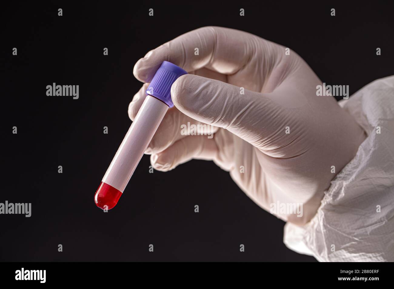 Hände des männlichen Arztes in weißer Schutzkleidung und medizinischen Handschuhen zur Aufnahme der Blutprobe Stockfoto
