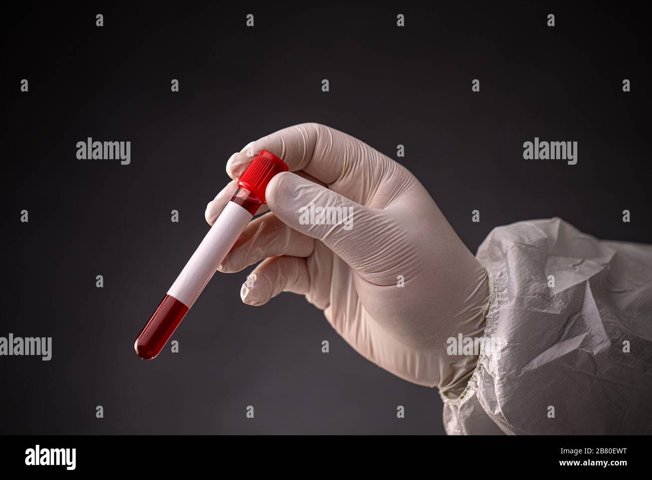 Die Hand des Wissenschaftlers in weißer Schutzkleidung und medizinischen Handschuhen, die das Bluttestrohr halten Stockfoto
