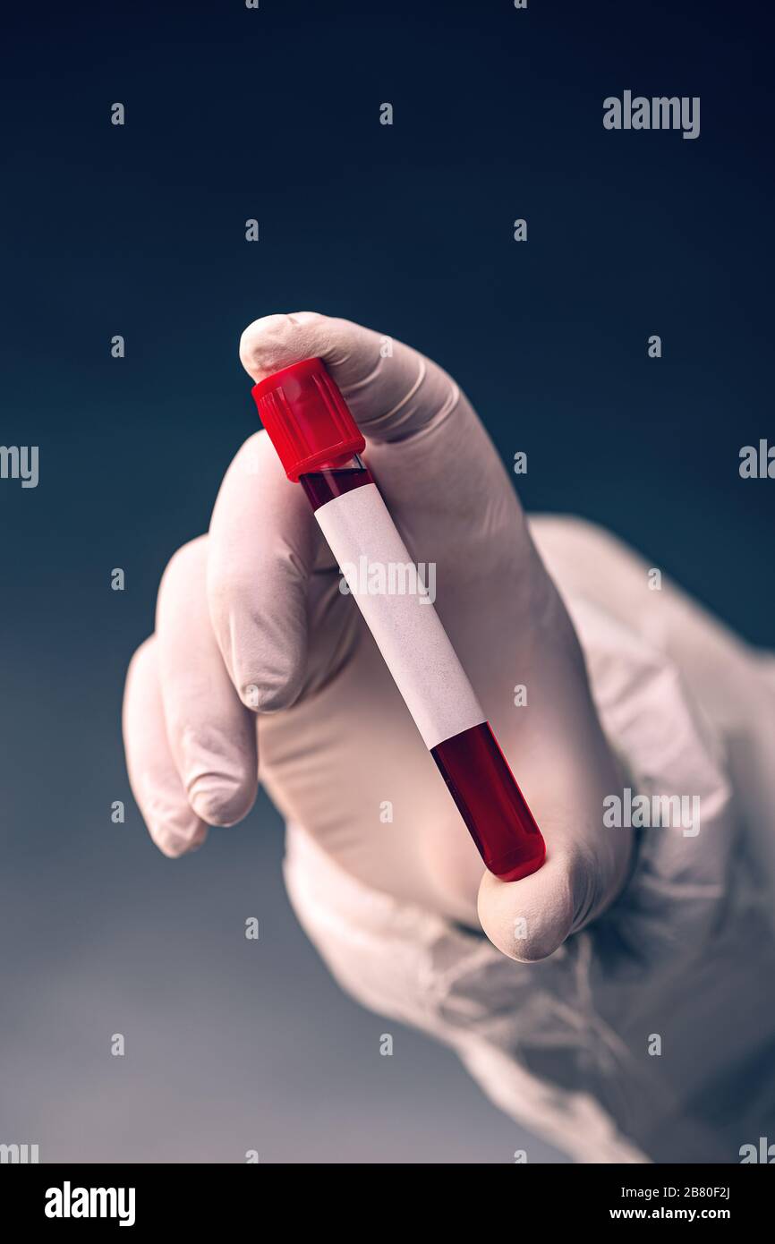 Die Hand des Wissenschaftlers in weißer Schutzkleidung und medizinischen Handschuhen, die das Bluttestrohr halten Stockfoto