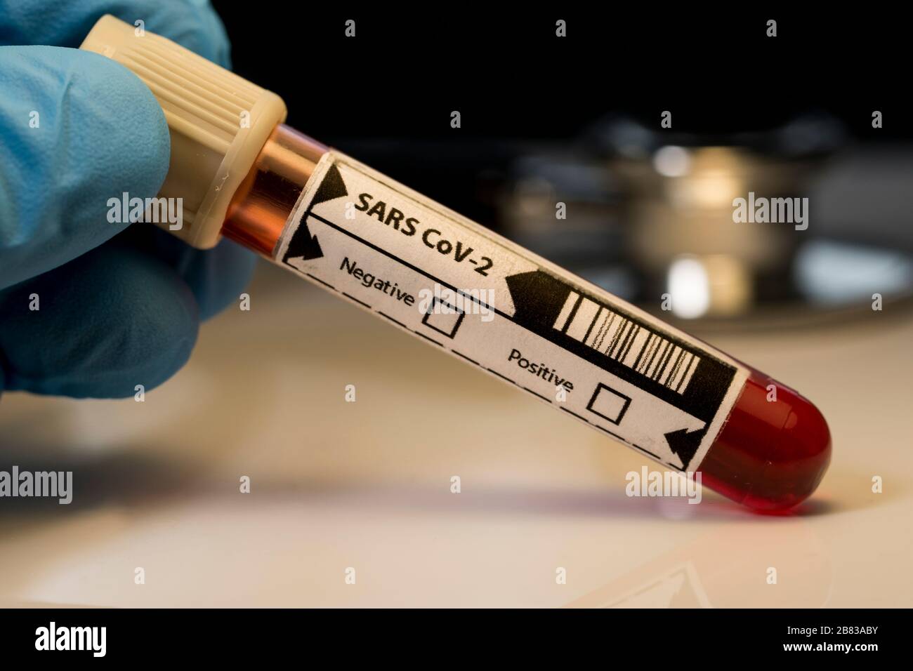 SARS-COV-2 Blutprobe Nahaufnahme. Handschuhflaschen mit menschlichem Blut für die Covid-19-Tests im Labor. Globale Pandemie Outbre Stockfoto