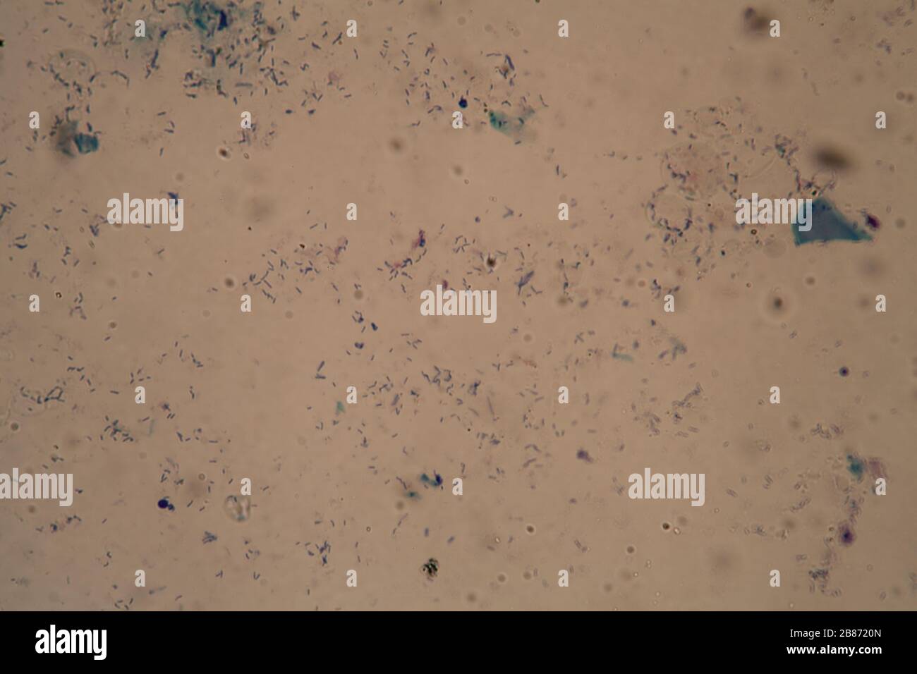 Tuberkulose Bakterien unter dem Mikroskop 400x Stockfoto
