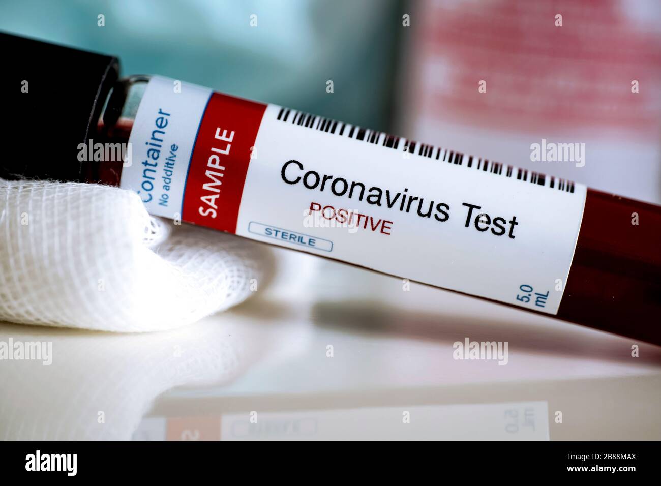 Blutproben auf Vorhandensein eines Coronavirus (COVID-19) Tubus mit einer Blutprobe, die positiv auf Coronavirus getestet wurde. Stockfoto