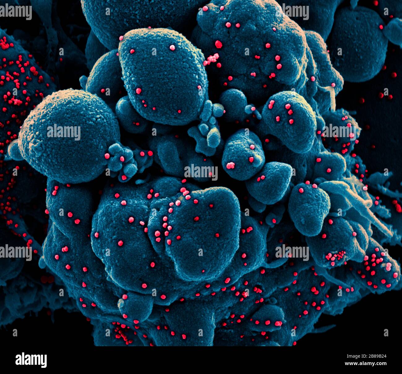 Ein Transmissionselektronenmikrograph aus COVID-19, neuartigen Coronavirus, einer apoptotischen Zelle, die stark mit SARS-COV-2-Virus-Partikeln infiziert ist, isoliert von einer Patientenprobe in der NIAID Integrated Research Facility am 18. März 2020 in Fort Detrick, Maryland. Stockfoto