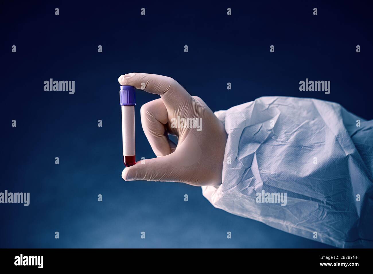 Hände eines Labortechnikers mit einem Röhrchen Blutprobe bereit für die Prüfung Stockfoto