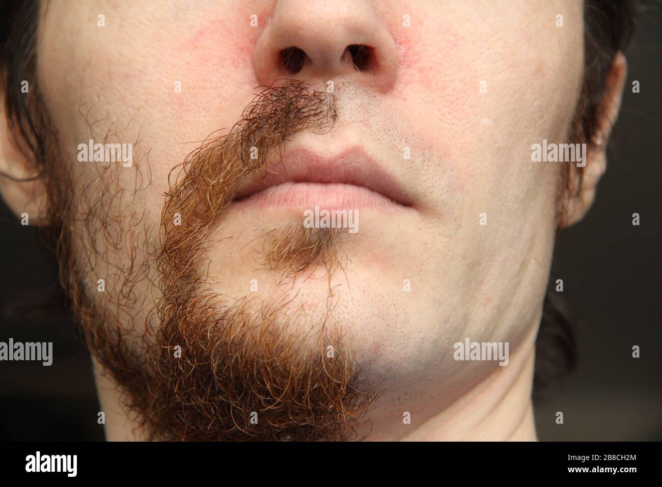 Der untere Teil des Gesichts eines weißen Mannes. Die Hälfte des Gesichts ist rasiert, die andere Hälfte mit Bart und Schnurrbart Stockfoto