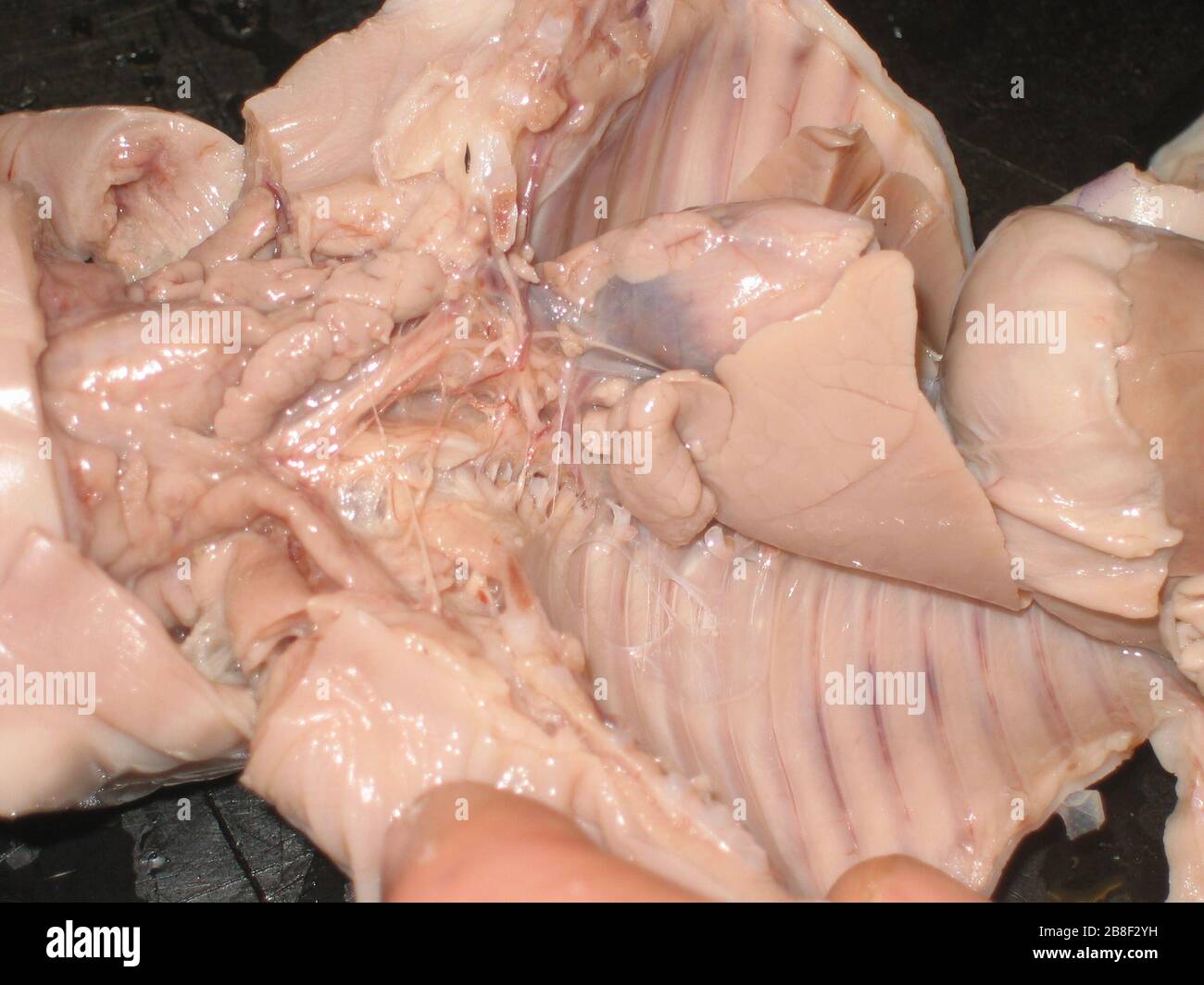 Pericardium Diaphragm Stockfotos Und Bilder Kaufen Alamy