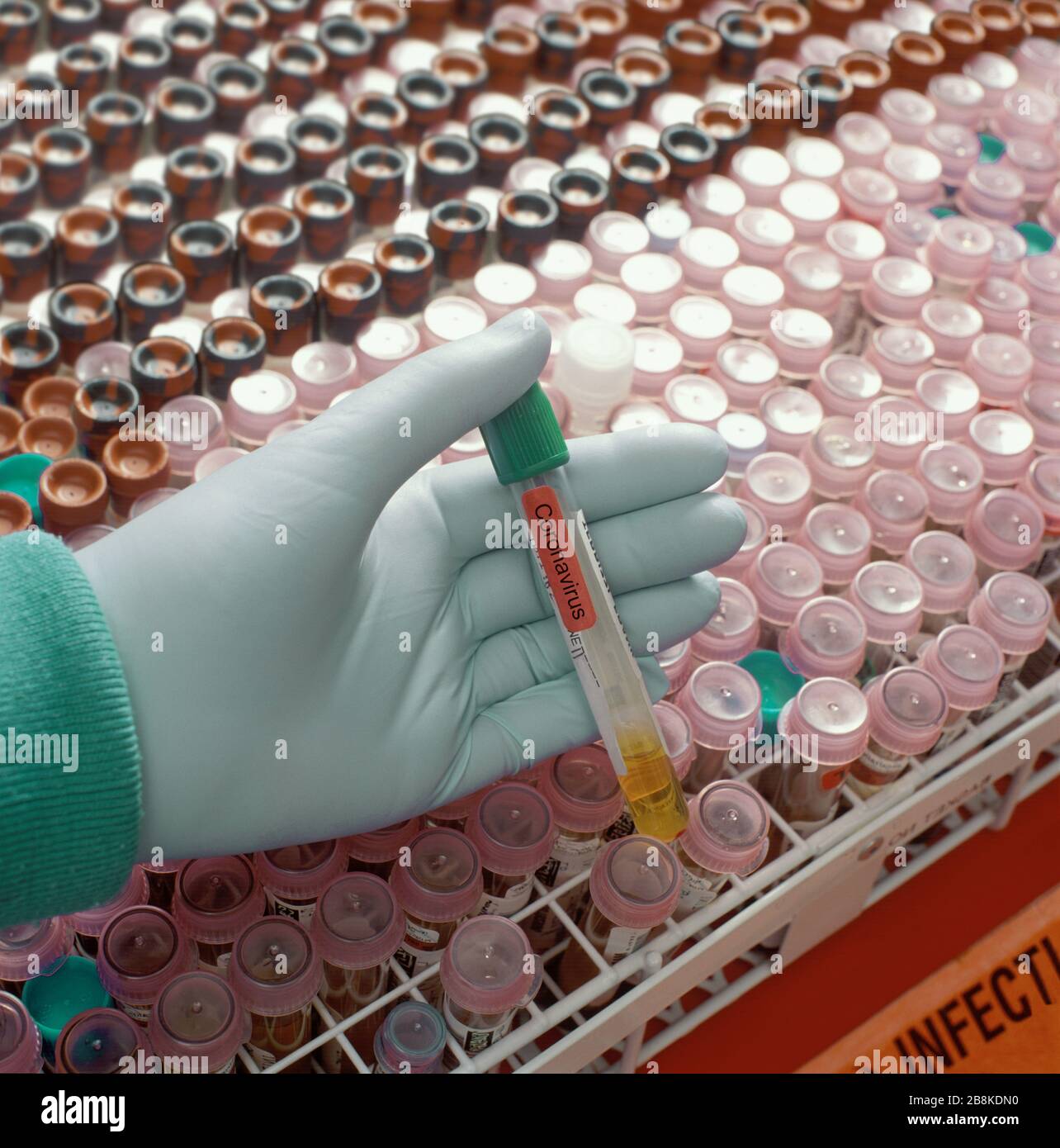 Hand hält Novel Coronavirus Covid-19-Testfläschchen, USA Stockfoto
