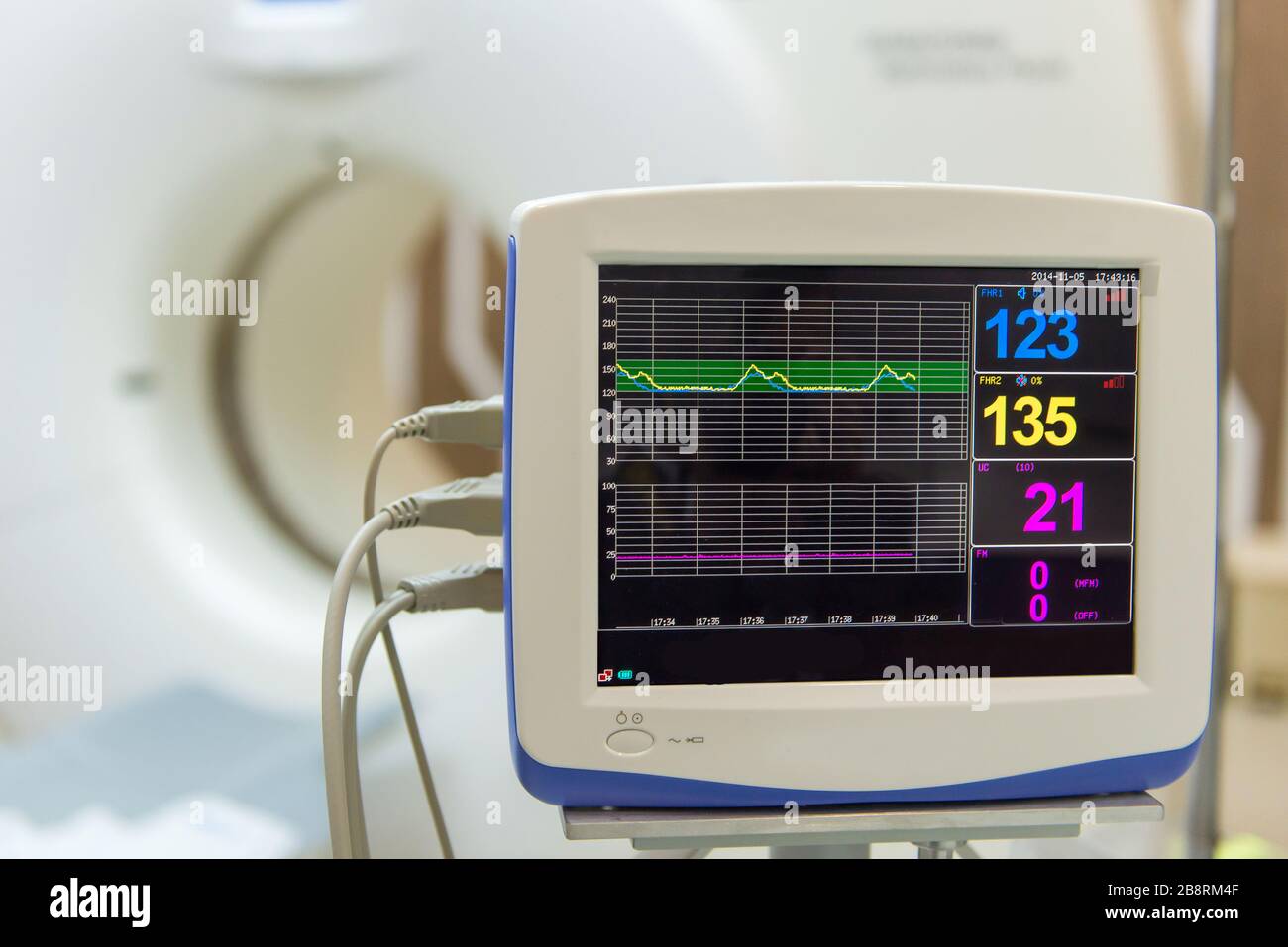 Hochentwickelte medizinische Geräte für MRT-Scanner im Krankenhaus. Stockfoto