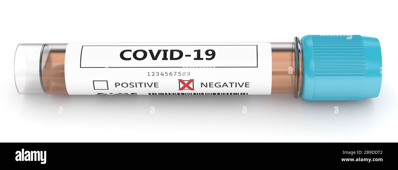 3D-Rendering des Kovid-19-Labortests mit negativem Nasenabstrich über weißem Hintergrund Stockfoto
