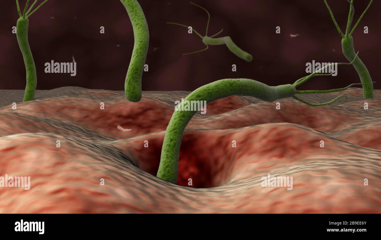Konzeptionelles Bild von helicobacter Pylori-Bakterien, die in den Magen gelangen. Stockfoto