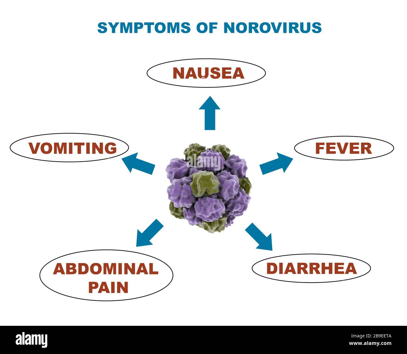 Medizinisches Diagramm mit Symptomen des Norovirus. Stockfoto