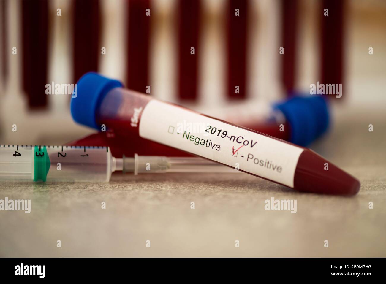 Reagenzglas mit Blutprobe für COVID-19-Test, neuartiges Coronavirus 2019. Impfkonzept, Covid-19 Coronavirus diagnostisch, Heilung für das Grippevirus Stockfoto