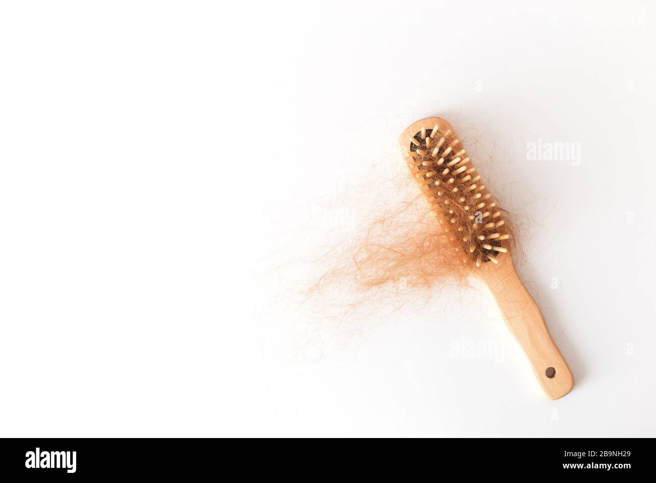 Haarausfall. Kammaufsatz für Haarausfall Stockfoto