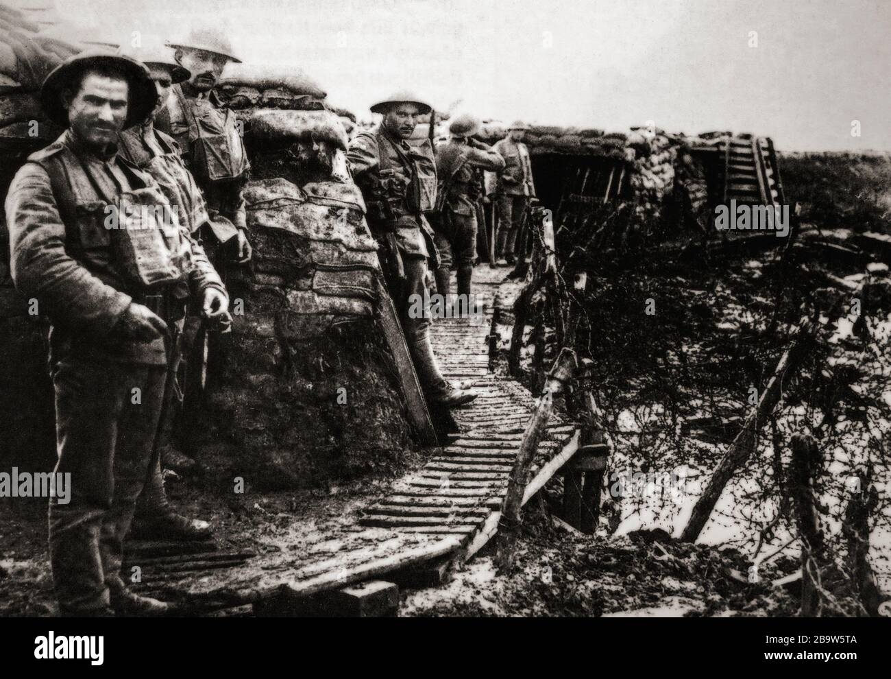 Portugiesische Truppen in einem Brustgraben in der Nähe von Neuve Chapelle während der Schlacht an der Lys, alias Vierte Schlacht von Ypern, Wurde vom 7. April bis 29. April 1918 gekämpft und war Teil der deutschen Frühjahrsoffensive in Flanderns während des ersten Weltkriegs. Ursprünglich war geplant, Ypern gefangen zu nehmen, die britischen Streitkräfte zurück in die Kanalhäfen und aus dem Krieg zu zwingen. Stockfoto