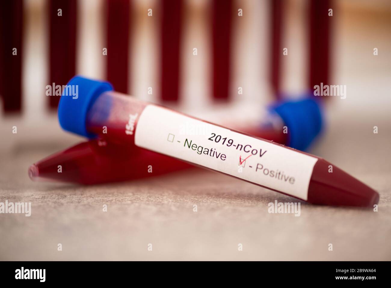 Reagenzglas mit Blutprobe für COVID-19-Test, neuartiges Coronavirus 2019. Impfkonzept, Covid-19 Coronavirus diagnostisch, Heilung für das Grippevirus Stockfoto