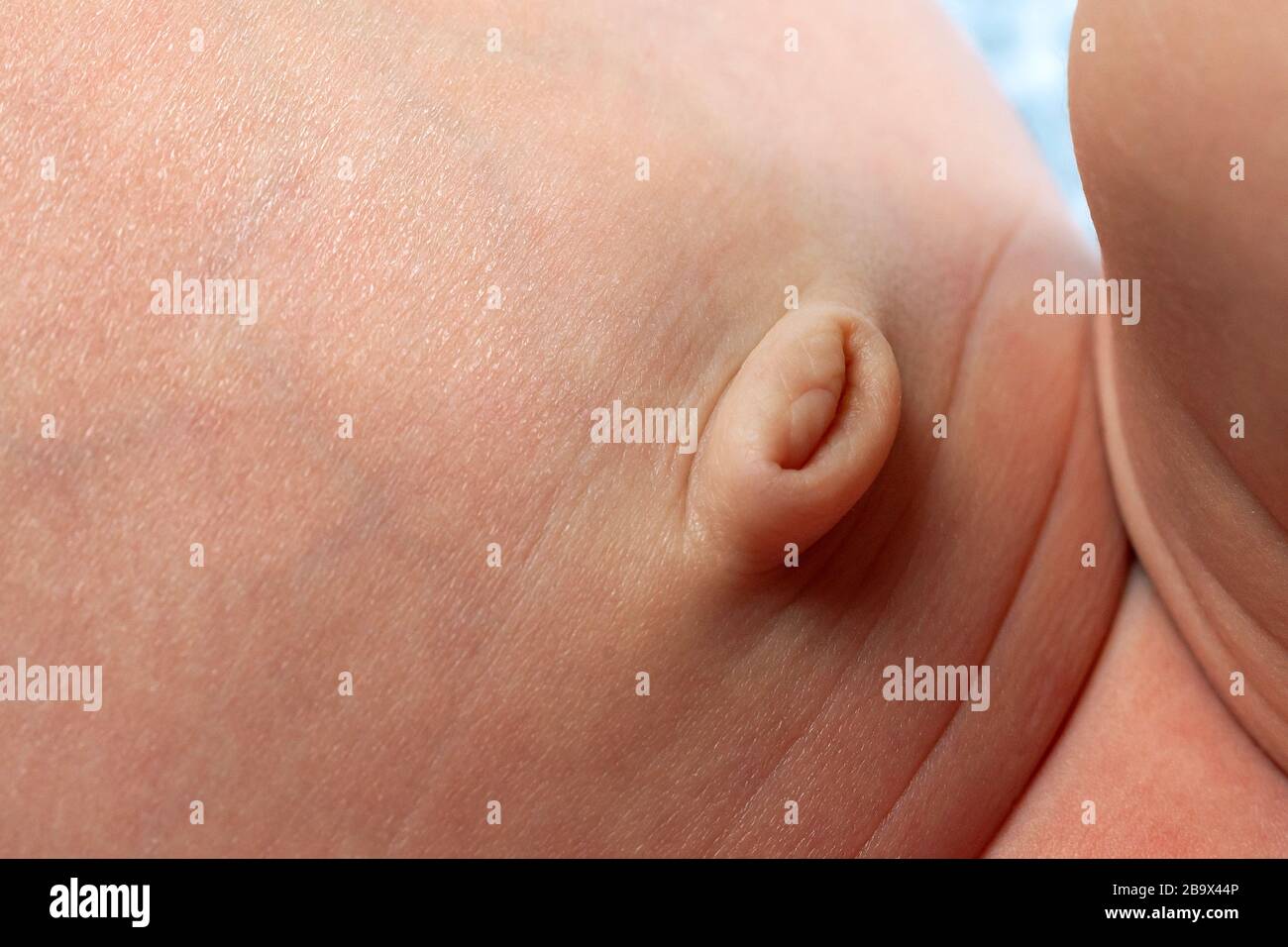 Nabel des neugeborenen Babys, Nahaufnahme Stockfoto