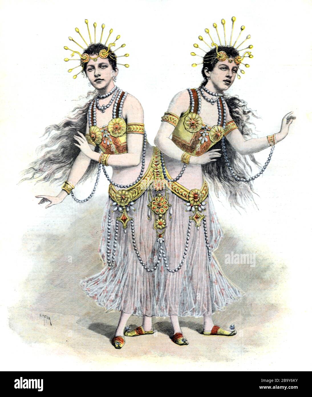 Zusammengefühlte Twins Rosa & Joseph Blazek oder Ruzena & Josefina Blazkovi, bekannt als The Bohemian Twins (1878-1922) waren es Pygopagus oder Lliopgus Twins, die am Becken antraten. Alte oder alte Illustration Stockfoto