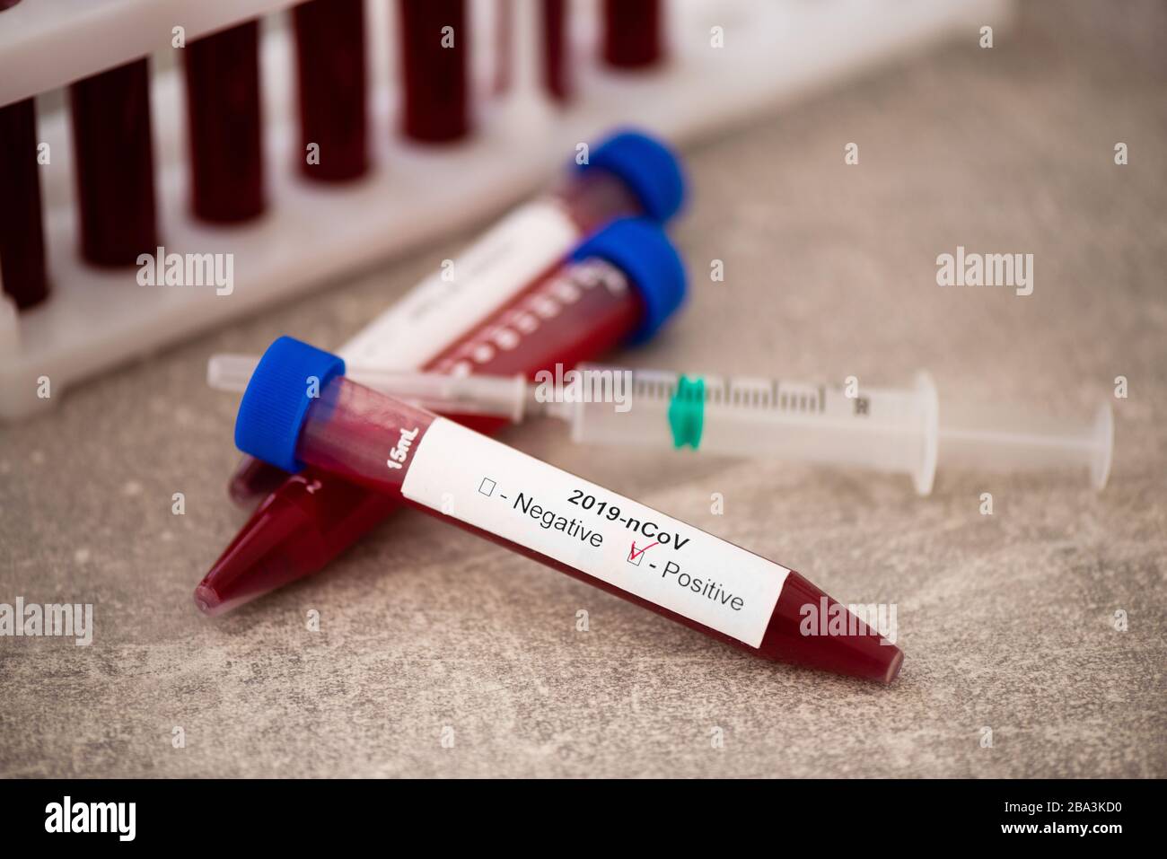 Reagenzglas mit Blutprobe für COVID-19-Test, neuartiges Coronavirus 2019. Impfkonzept, Covid-19 Coronavirus diagnostisch, Heilung für das Grippevirus Stockfoto