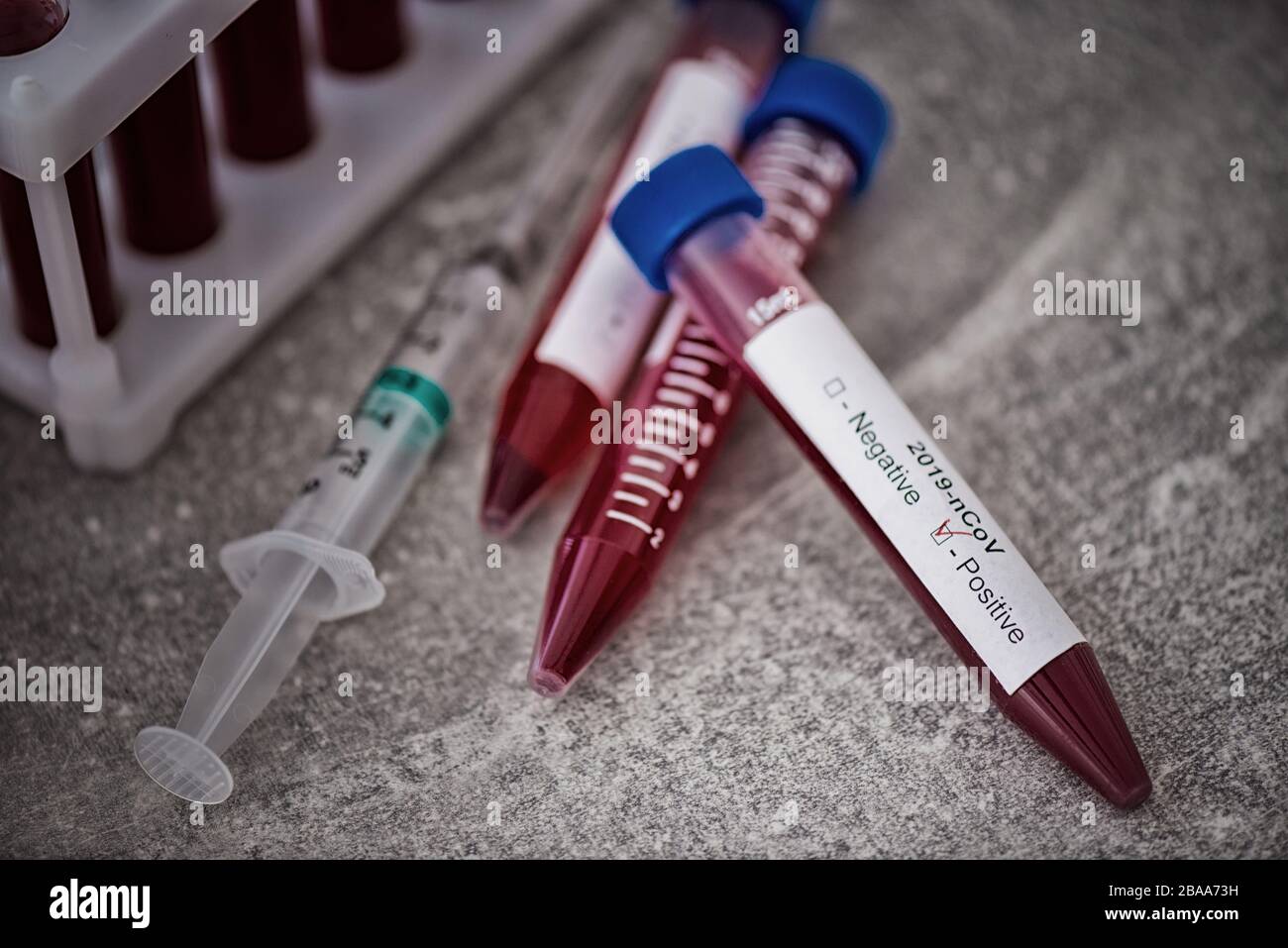 Reagenzglas mit Blutprobe für COVID-19-Test, neuartiges Coronavirus 2019. Impfkonzept, Covid-19 Coronavirus diagnostisch, Heilung für das Grippevirus Stockfoto
