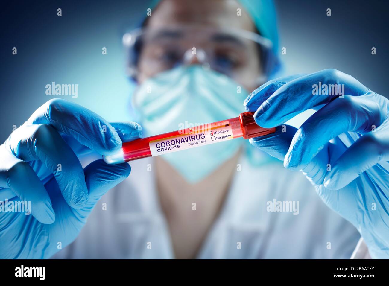 Chemiker Mit Blauen Schutzhandschuhen Hält Teströhrchen-Positives Analyseergebnis Stockfoto
