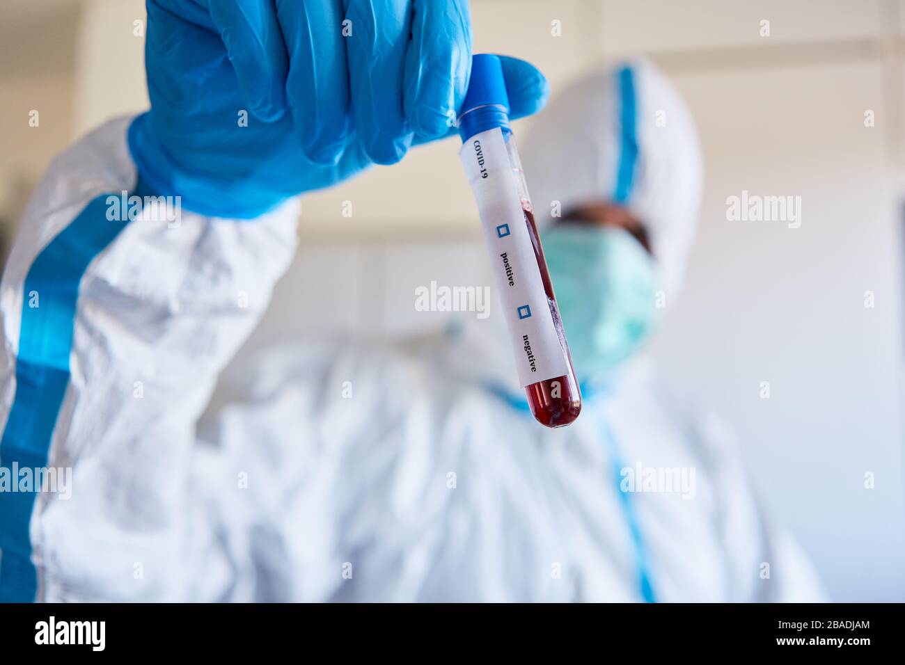 Forscher in Schutzkleidung mit Covid-19-Blutprobe für die Coronavirus-Forschung im Labor Stockfoto