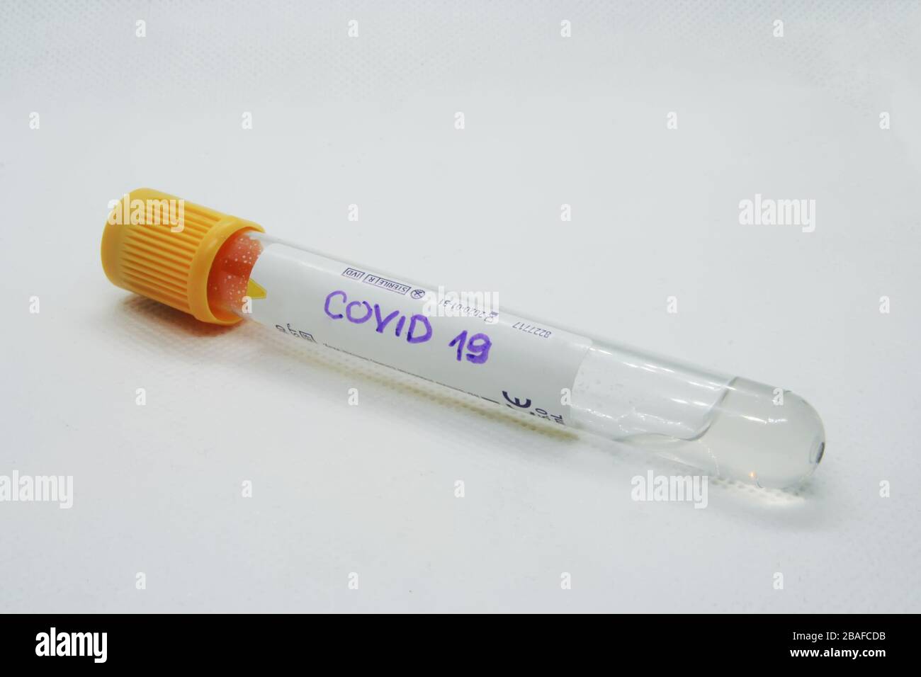 Virus-Reagenzglas. Testvirus. Viraler Infektionstest. Stockfoto