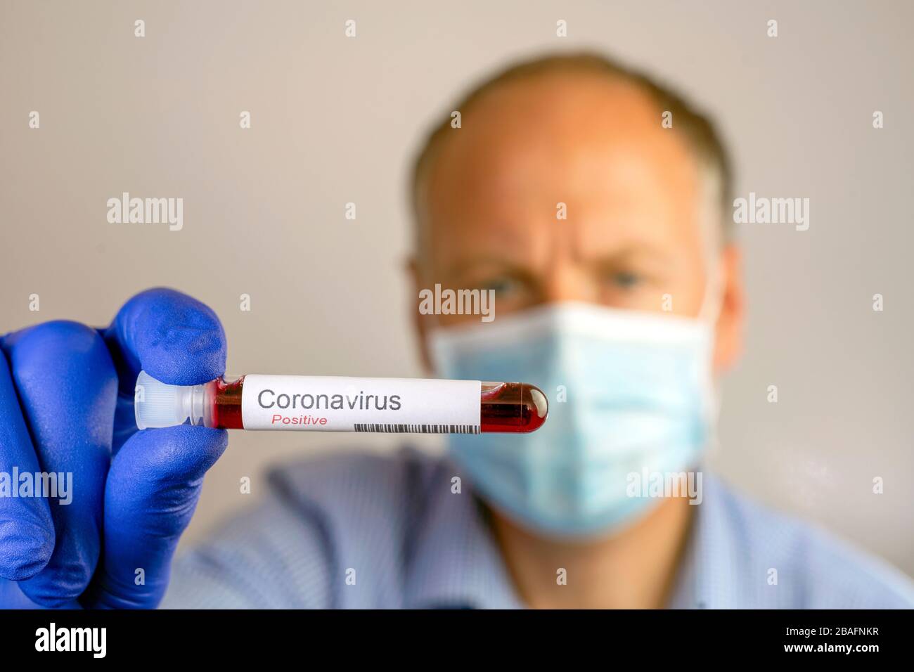 Ein ernsthafter Mann, der eine Schutzmaske trägt und ein positives Ergebnis seines Coronavirus Tests zeigt. Stockfoto
