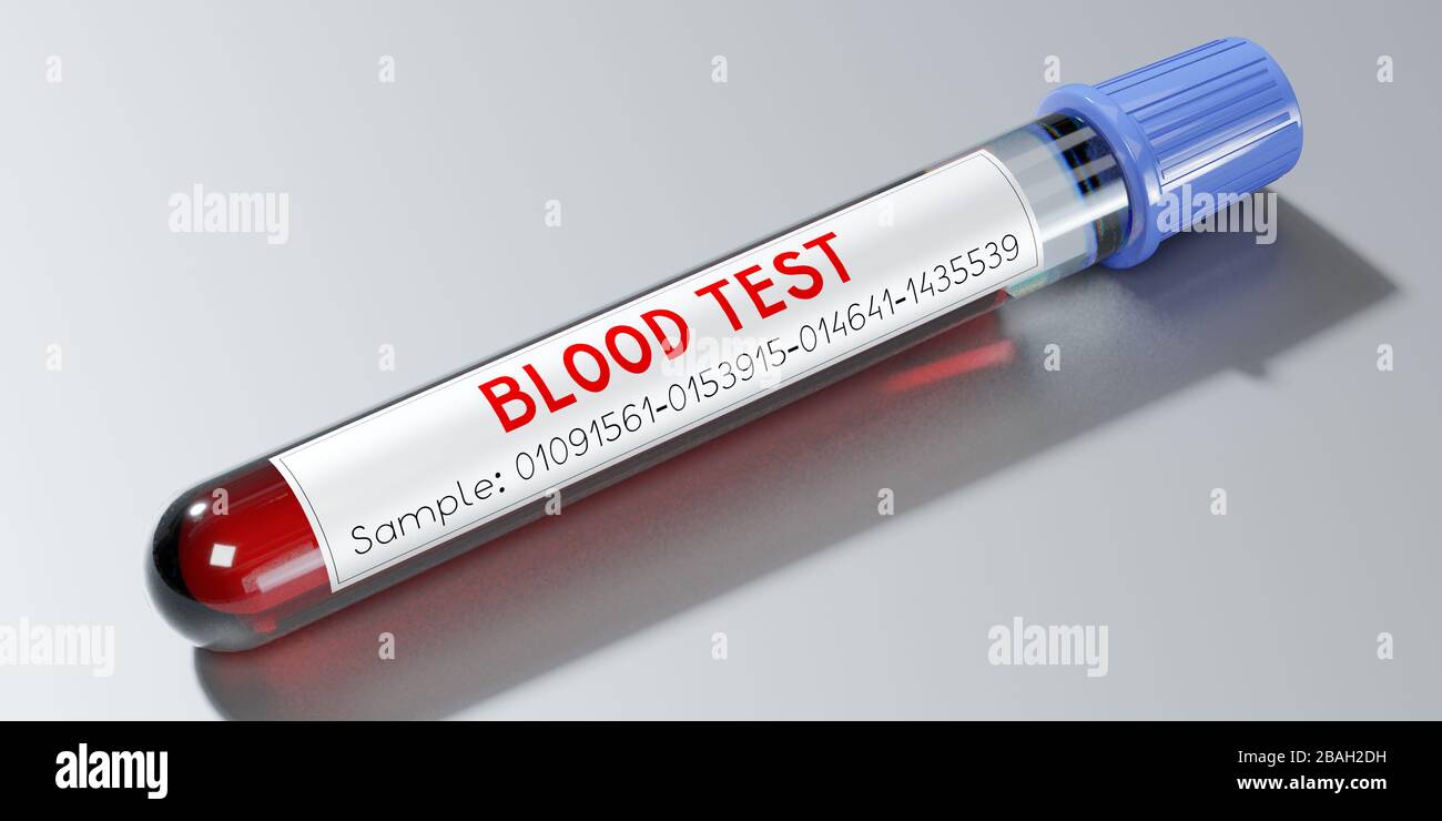 Bluttest, Reagenzglas - 3D-Abbildung Stockfoto
