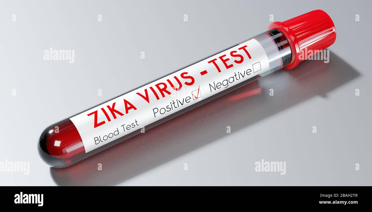 ZIKA-VIRUS - Reagenzglas, Bluttest - 3D-Abbildung Stockfoto