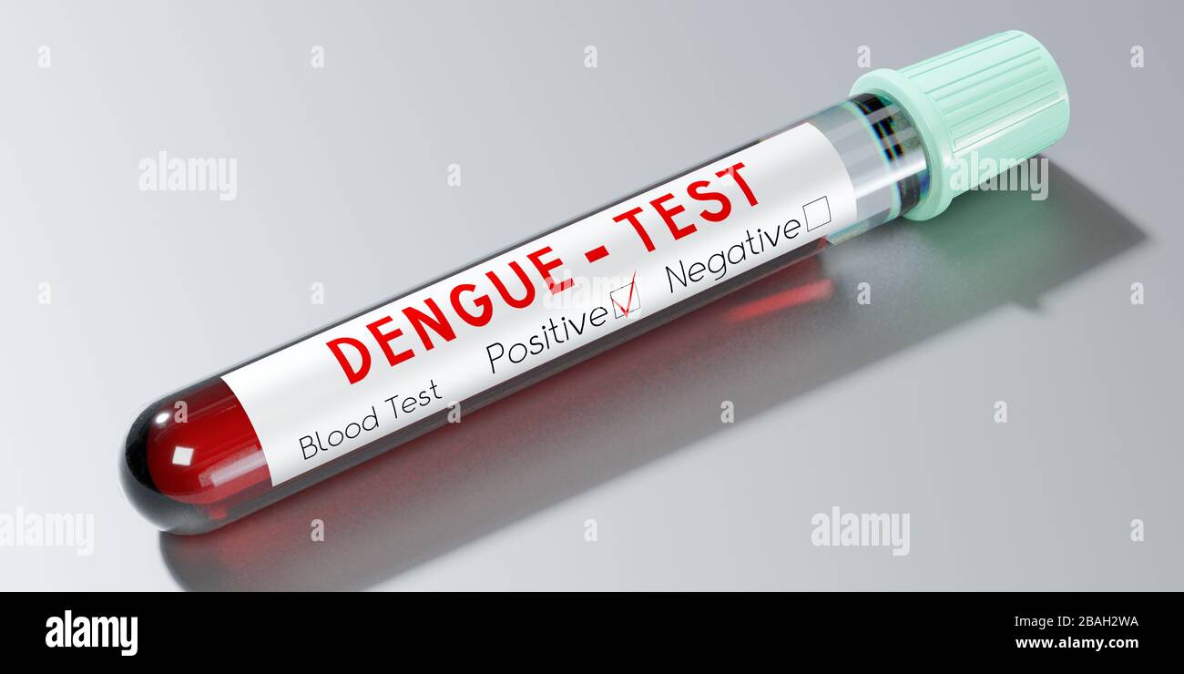 Dengue-Virus - Reagenzgläser, Blutuntersuchungen - 3D-Abbildung Stockfoto