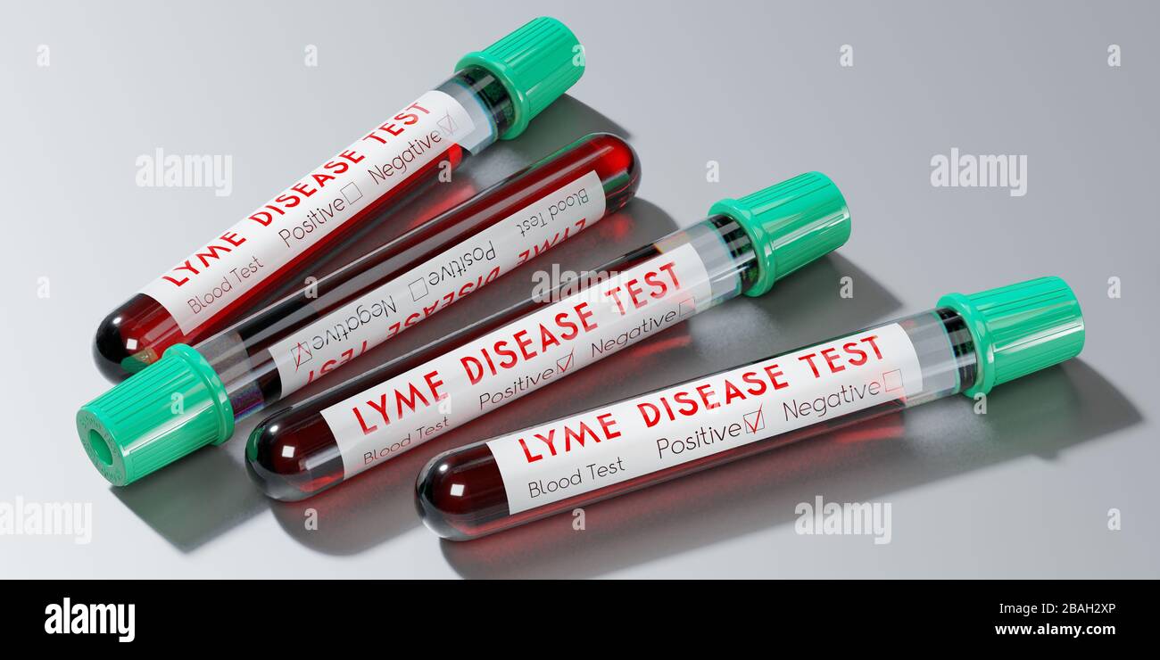 Lyme Disease Virus - Reagenzgläser, Blutuntersuchungen - 3D-Abbildung Stockfoto