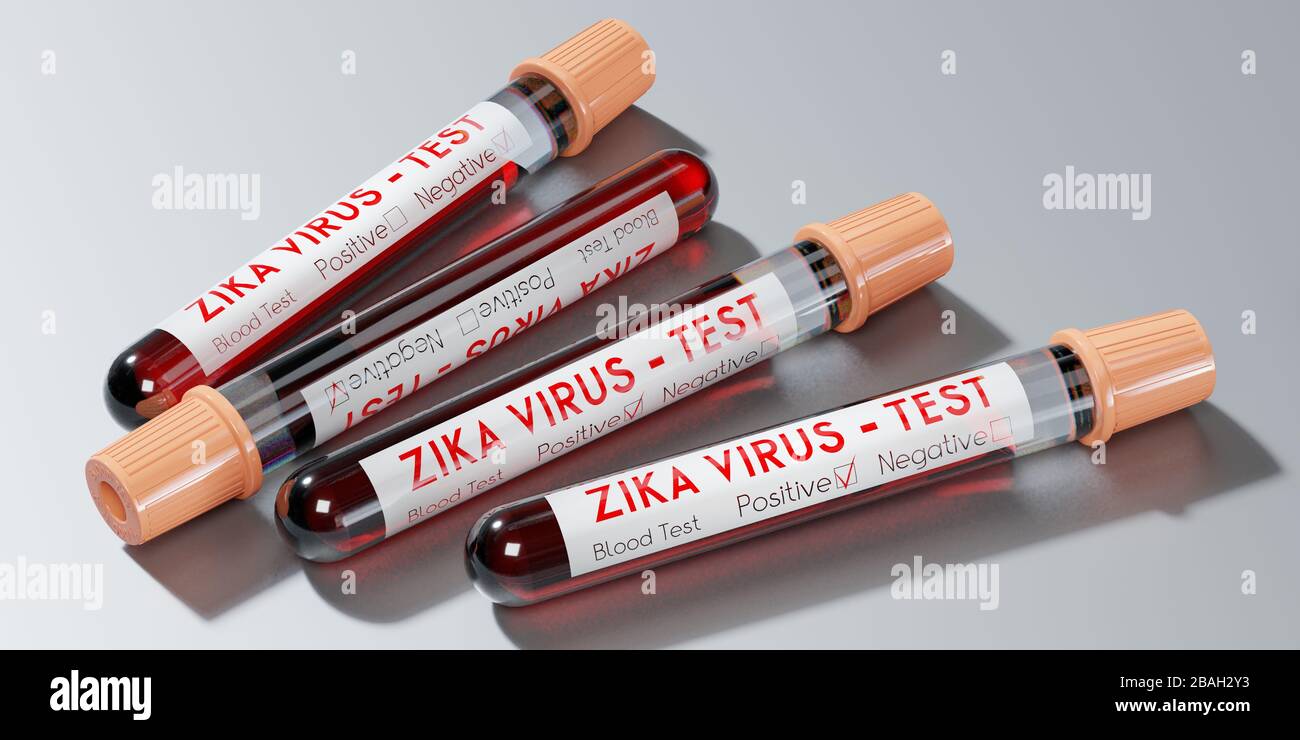 ZIKA-VIRUS - Reagenzgläser, Blutuntersuchungen - 3D-Abbildung Stockfoto
