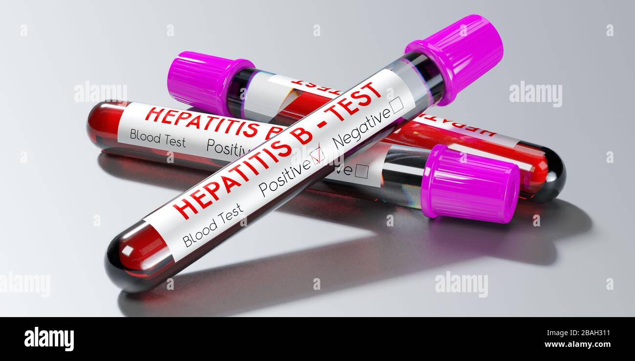 Hepatitis B-Virus - Reagenzgläser, Blutuntersuchungen - 3D-Abbildung Stockfoto