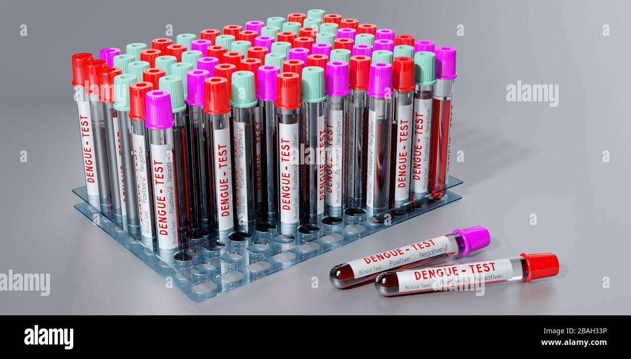 Dengue-Virus - Reagenzgläser, Blutuntersuchungen - 3D-Abbildung Stockfoto