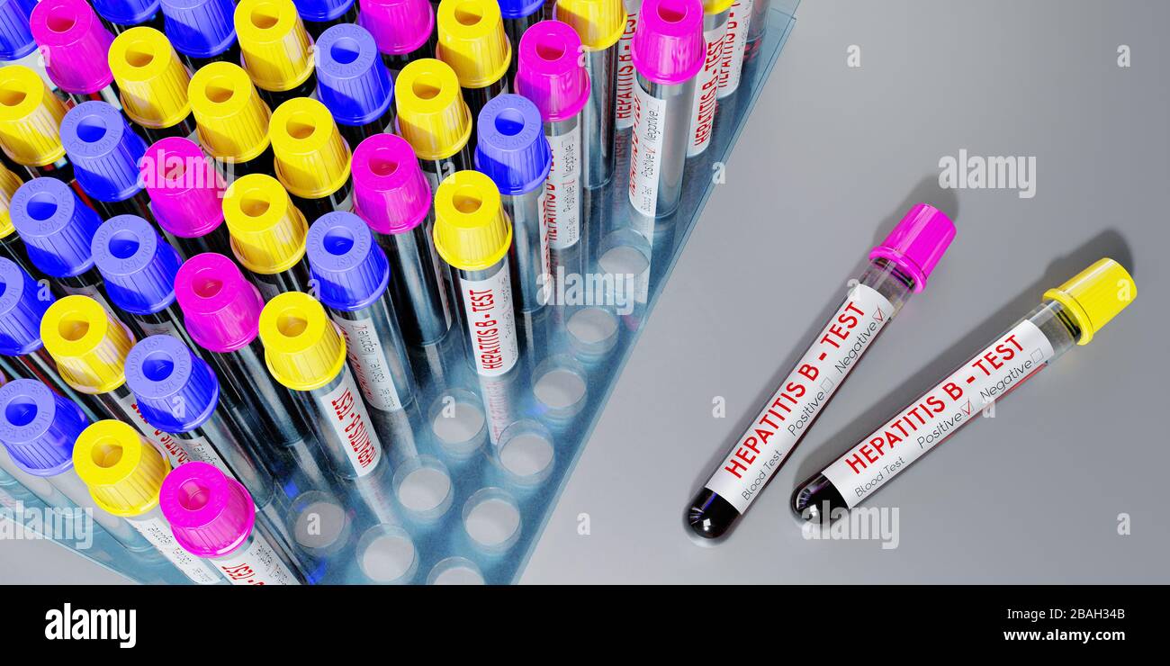 Hepatitis B-Virus - Reagenzgläser, Blutuntersuchungen - 3D-Abbildung Stockfoto