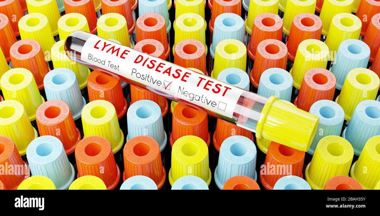 Lyme Disease Virus - Reagenzgläser, Blutuntersuchungen - 3D-Abbildung Stockfoto