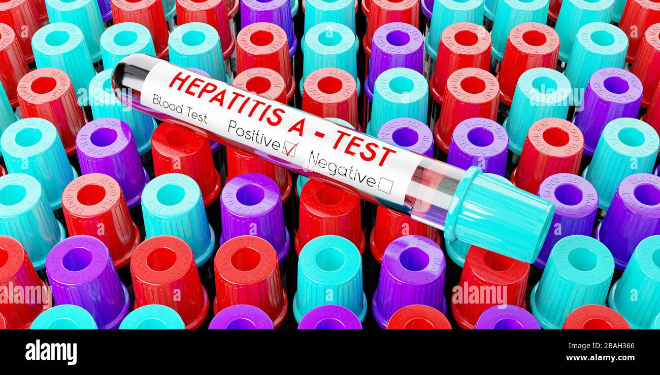Hepatitis-A-Virus - Reagenzgläser, Blutuntersuchungen - 3D-Abbildung Stockfoto