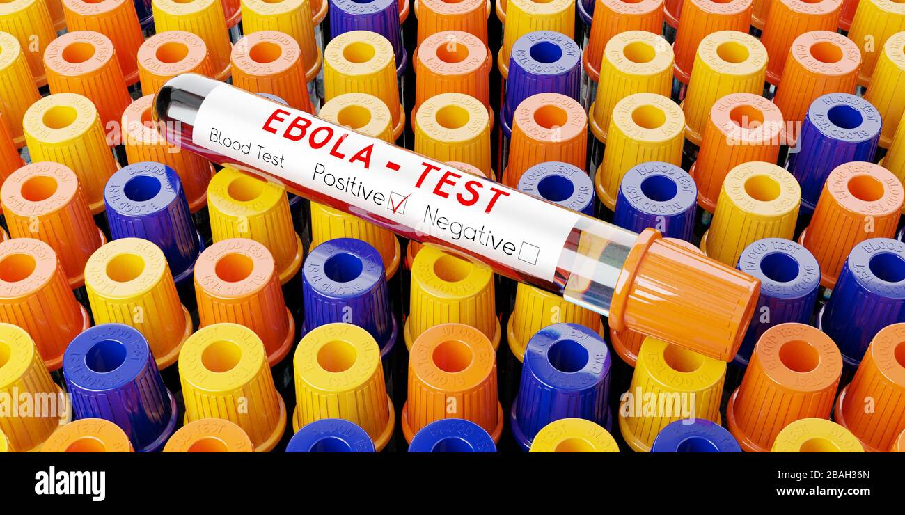 Ebola-Virus - Reagenzgläser, Blutuntersuchungen - 3D-Abbildung Stockfoto