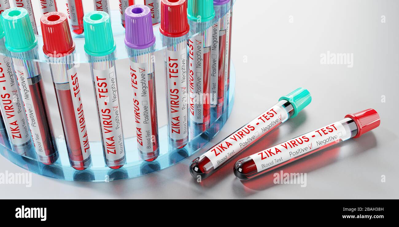 ZIKA-VIRUS - Reagenzgläser, Blutuntersuchungen - 3D-Abbildung Stockfoto