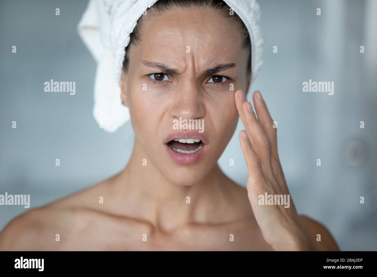 Frau berührt Gesicht fühlt sich über erste imitierte Falten gestresst Stockfoto