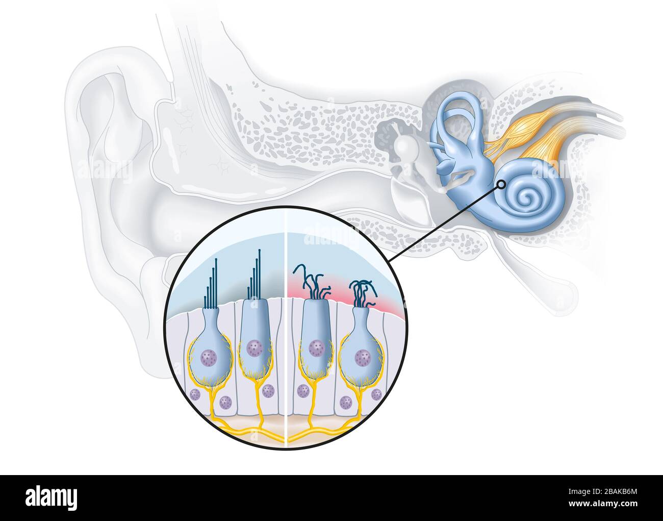 Gesunde und beschädigte Haarzellen im Inneren von Cochlea Stockfoto